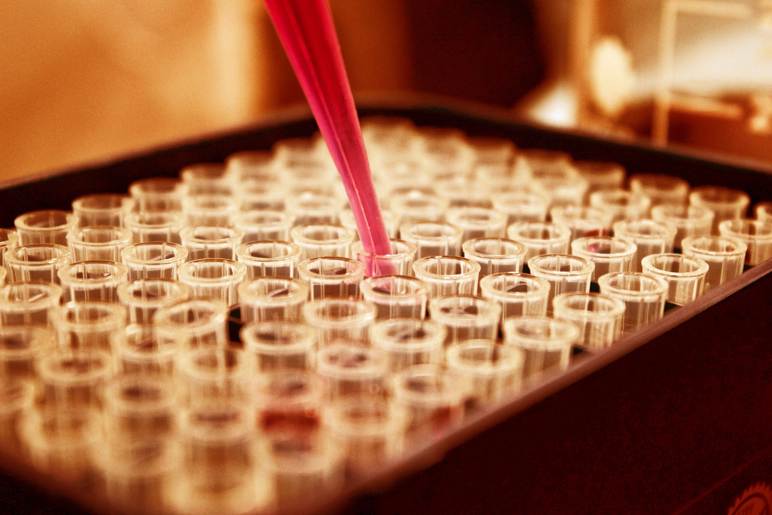 Bienvenidos a ALA Diagnostics